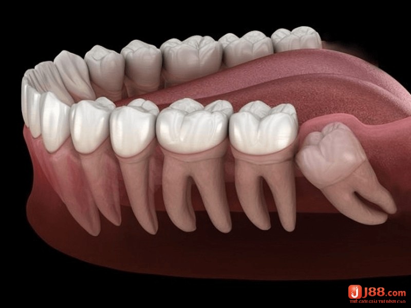 Mơ thấy mọc răng khôn cho thấy bạn đã sẵn sàng để đưa ra những quyết định khó khăn